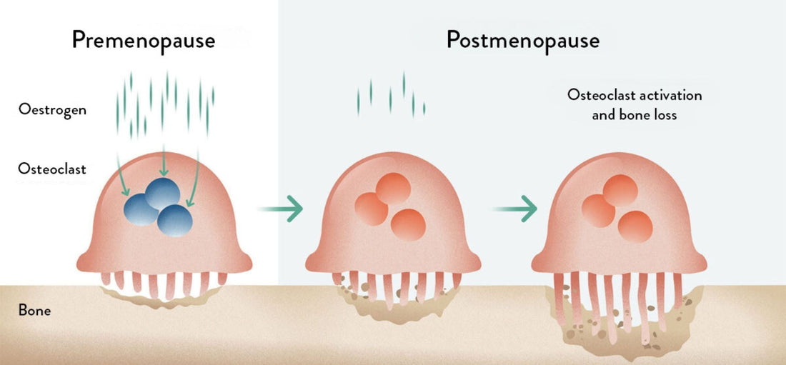 Bone health during menopause
