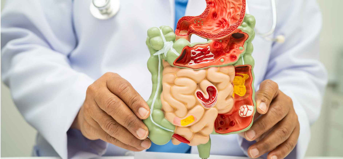 Gut health basics 101