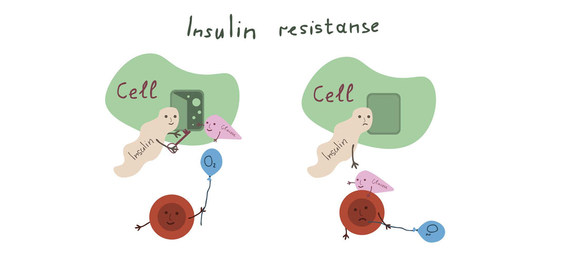 Insulin Resistance