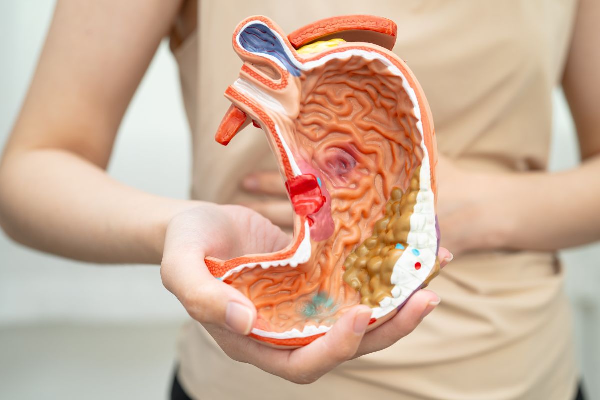 Could low stomach acid be affecting your digestion?